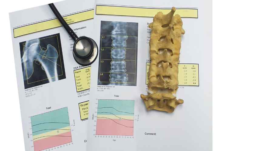 osteoporosi esami