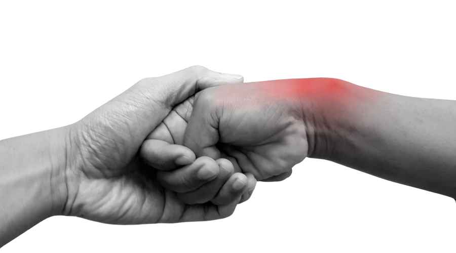 sindrome di de quervain
