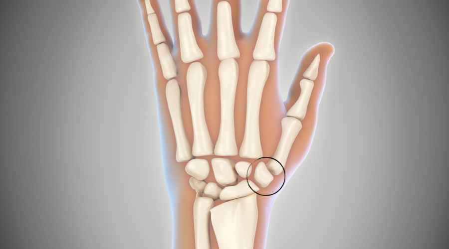 sindrome di de quervain anatomia