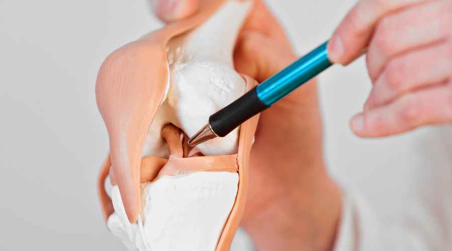 legamento crociato anteriore