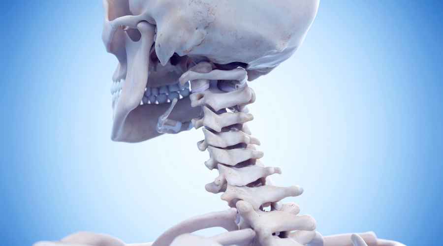 artrosi cervicale